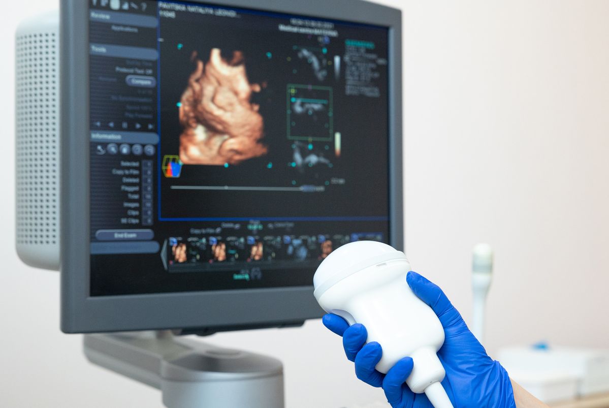 Các triệu chứng và chỉ định lâm sàng cần thực hiện siêu âm Doppler