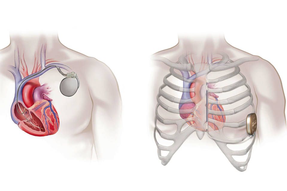 Các triệu chứng lâm sàng chỉ định khảo sát Doppler trên mặt cắt chuẩn
