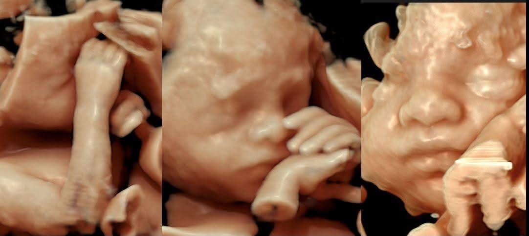Hành vi sinh lý và chuyển động của thai nhi nói lên điều gì?