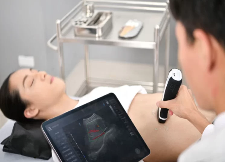 Ưu điểm của máy siêu âm cầm tay