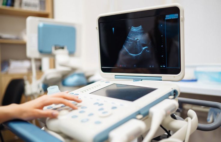 Hạn chế của đo Doppler thủ công