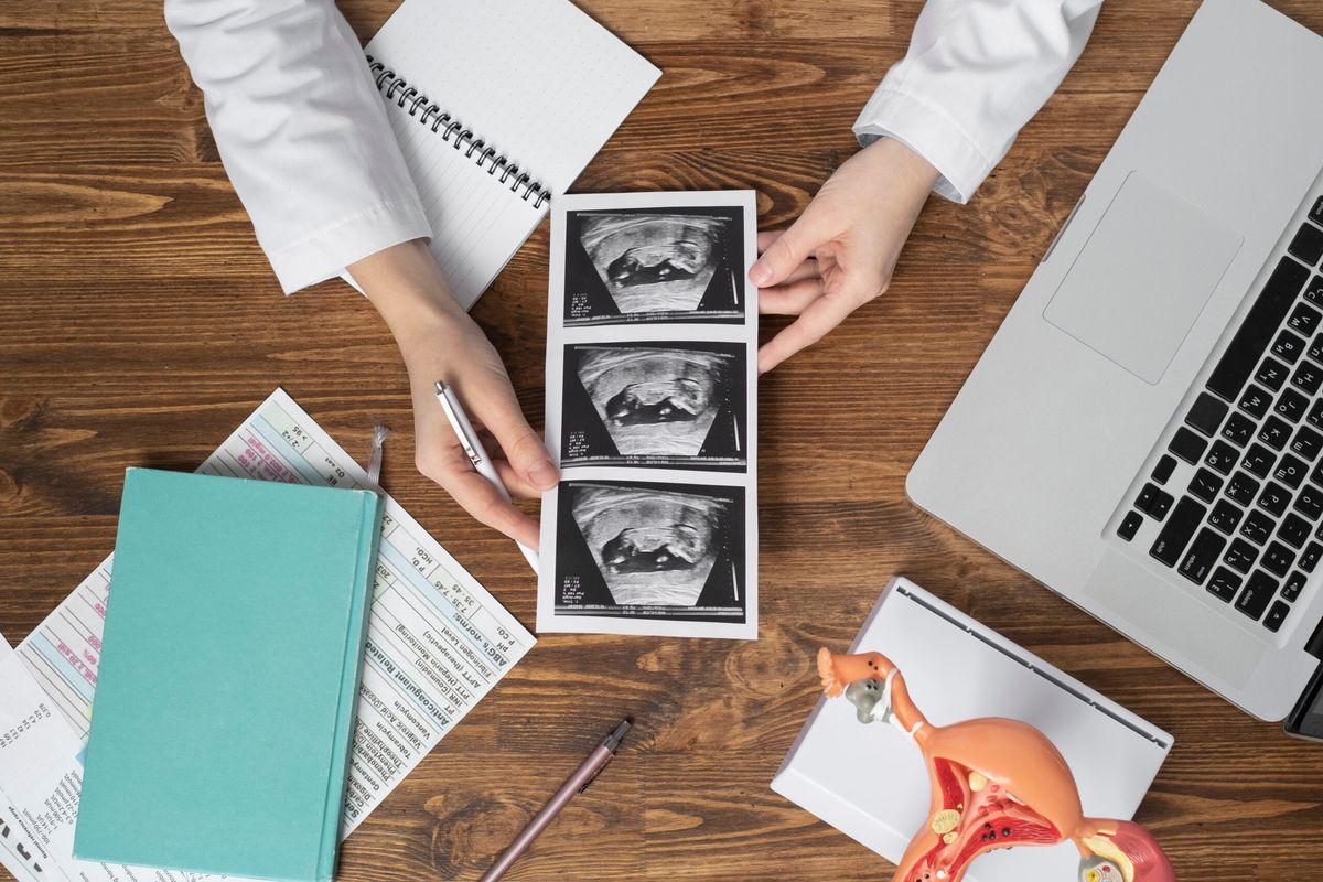 Sóng a bất thường trên Doppler ống tĩnh mạch có ý nghĩa gì?