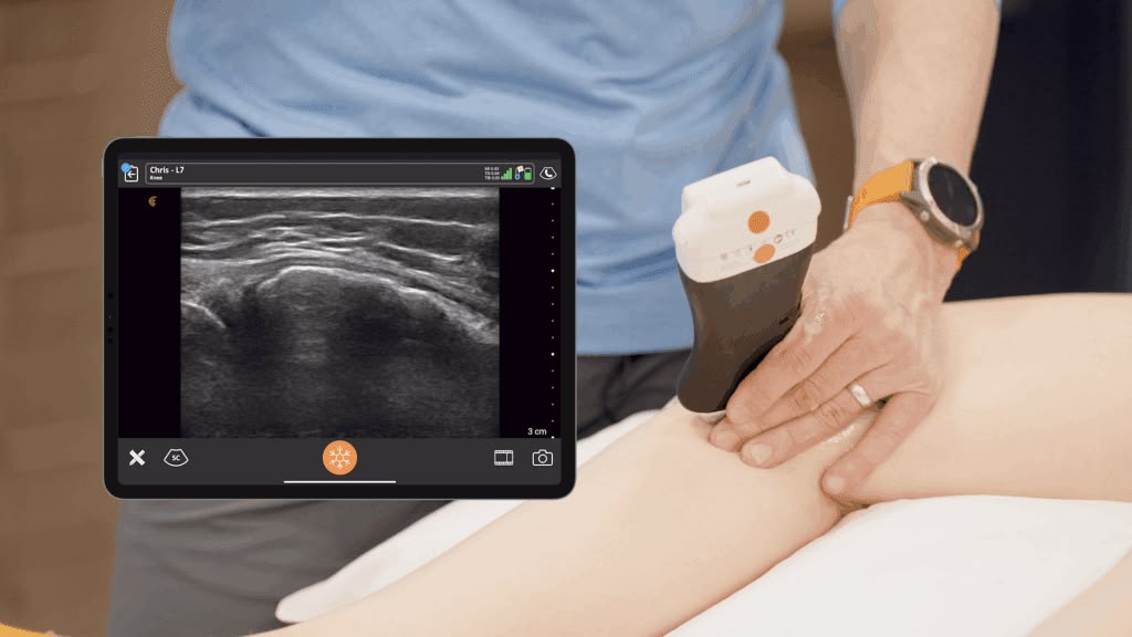 Ứng dụng phần mềm hỗ trợ chẩn đoán siêu âm Doppler AI