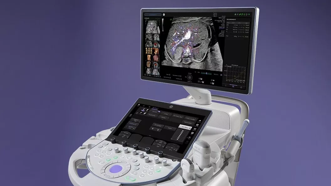 Hệ thống máy siêu âm Voluson của GE HealthCare